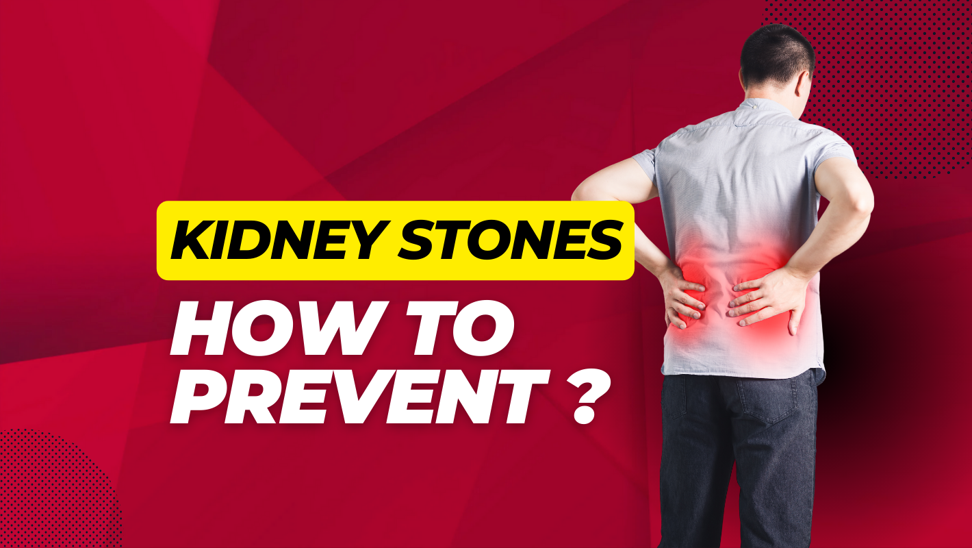 What are Kidney Stones?