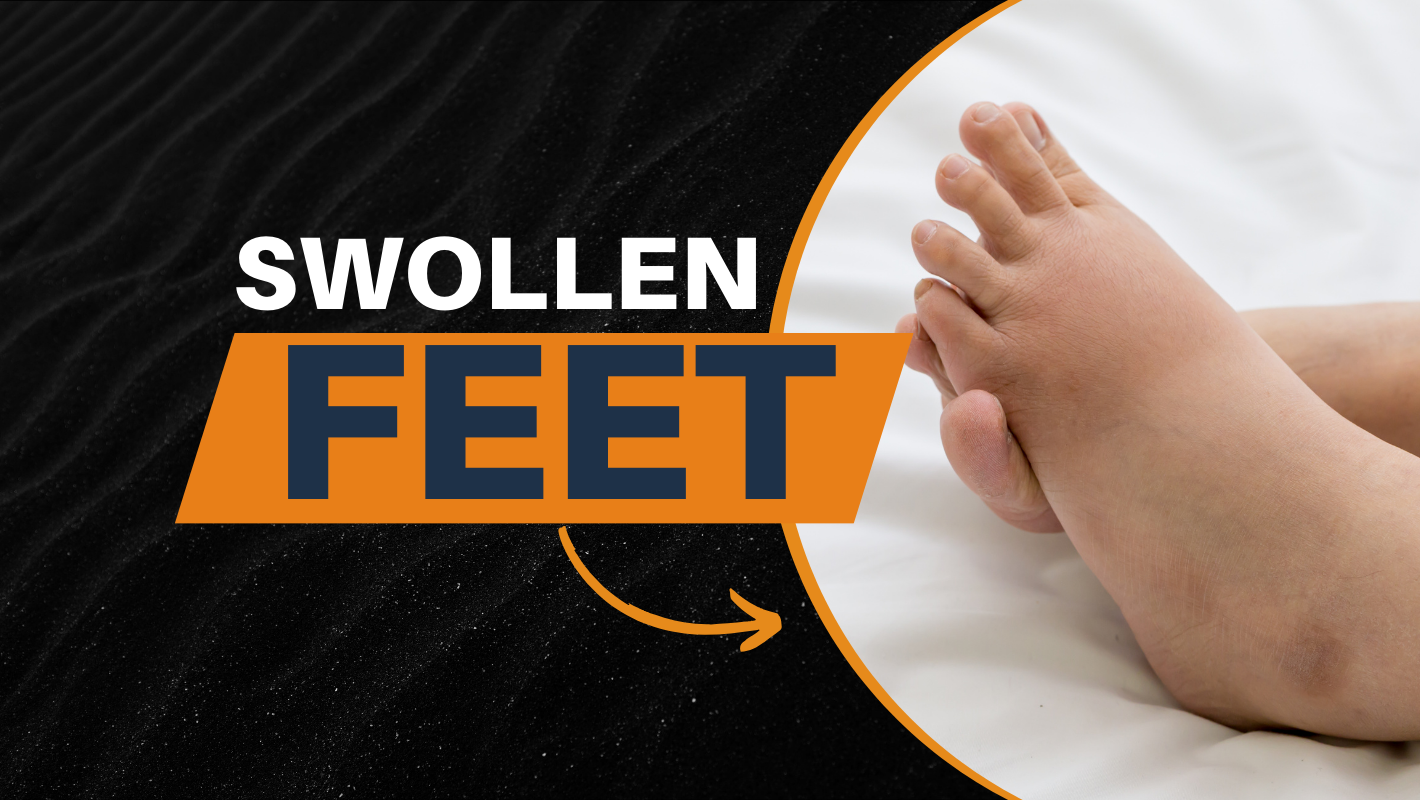 Swollen Feet and Ankles