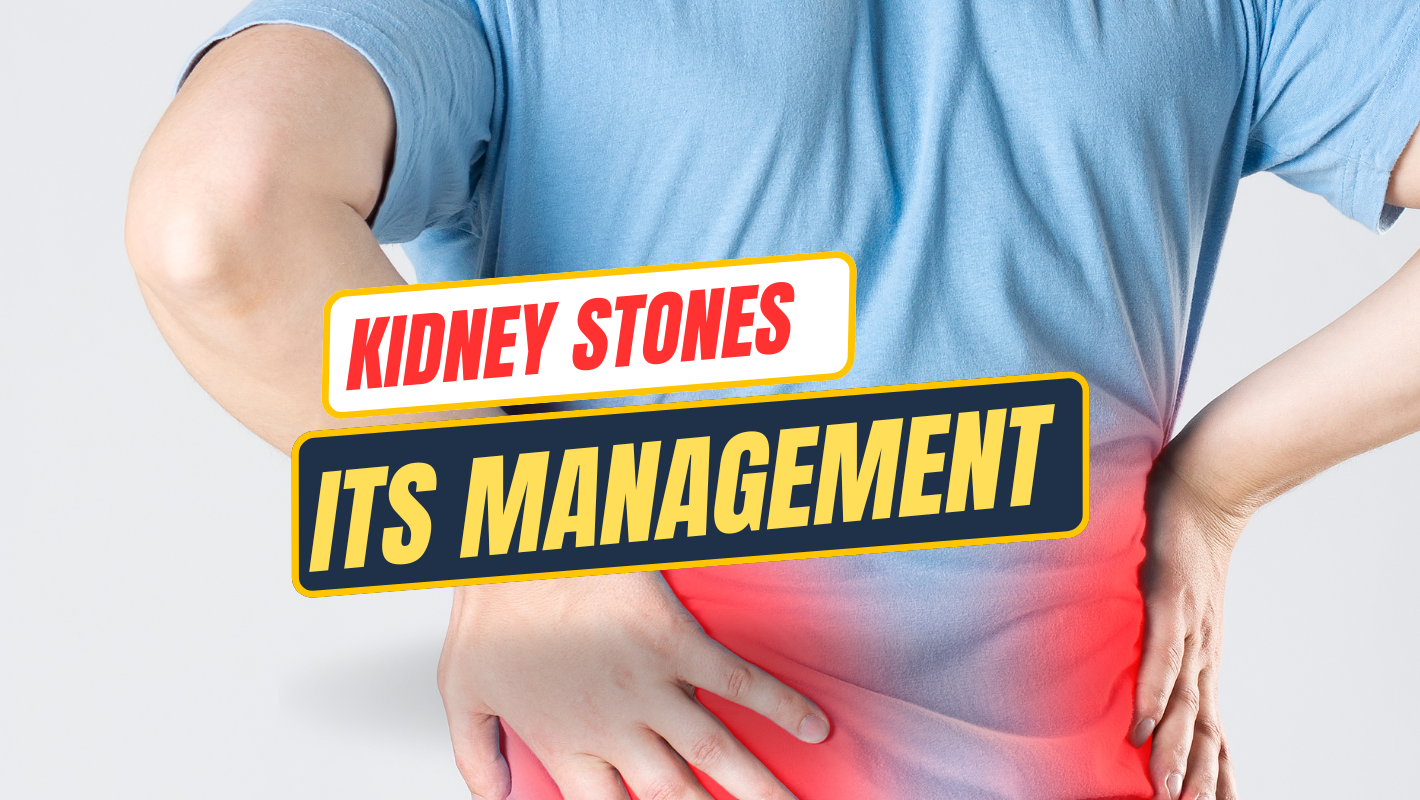 Kidney Stones and Their Management